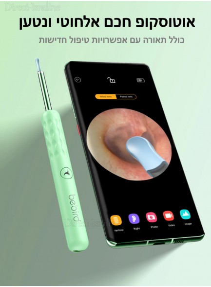 פנס אבחון אוטוסקופ רפואי חכם לרופא/אחות לבדיקת אוזניים נטען מופעל אפליקציה D6061 *במלאי מיידי*